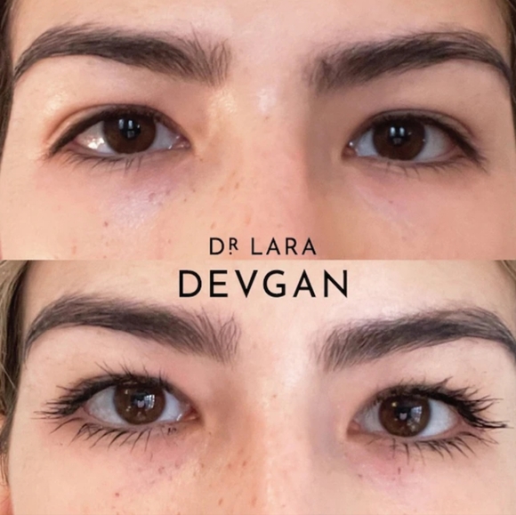 Dr. Lara Devgan Scientific BeautyExtreme Lengthening Mascara - Picture 4 of 4